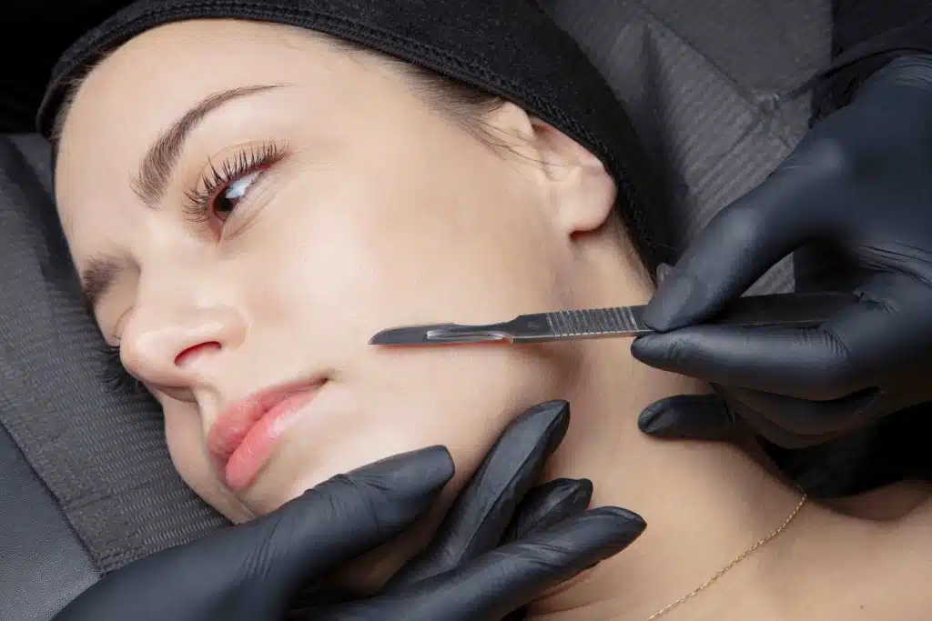 Dermaplaning Treatment in George UT at MaVie Med Spa