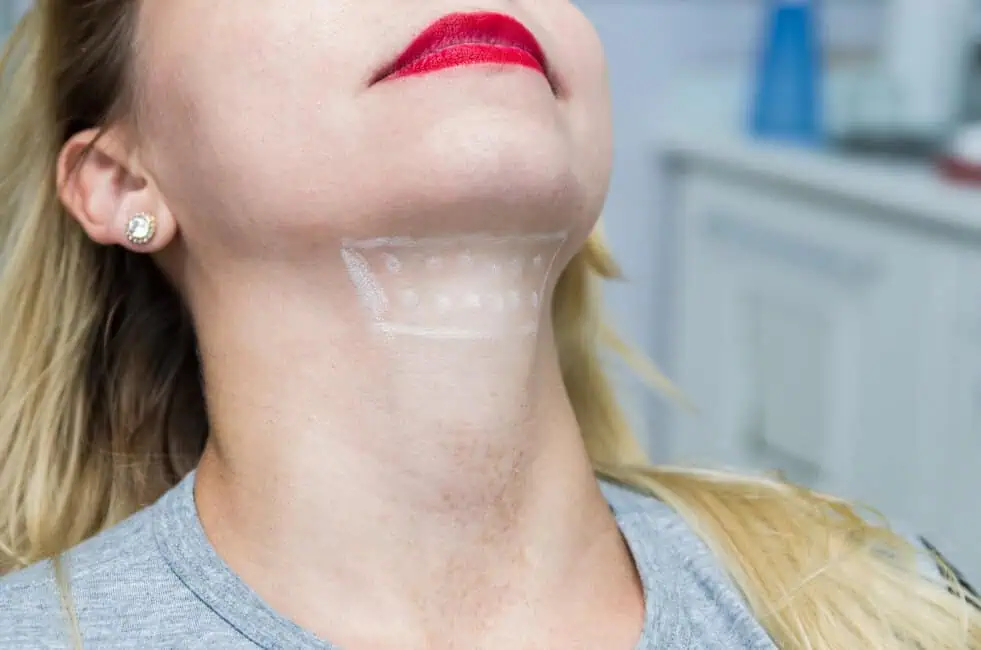 What to Expect During Your First Kybella Treatment