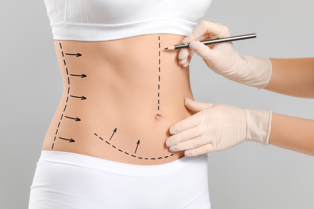 Muscle Contouring How Non-Surgical Body Contouring Builds Muscle & Reduce Fat