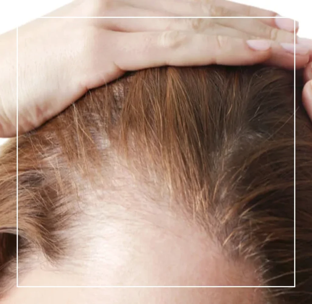 Hair Restoration Services In George UT