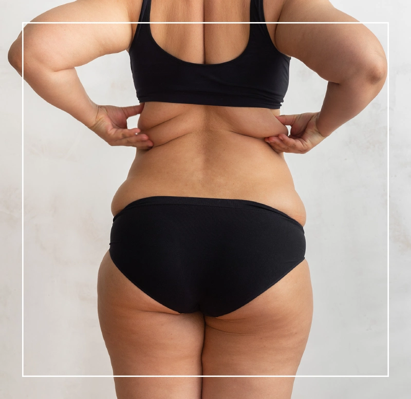 Woman back photo checking her weight in George, UT | MaVie Med Spa