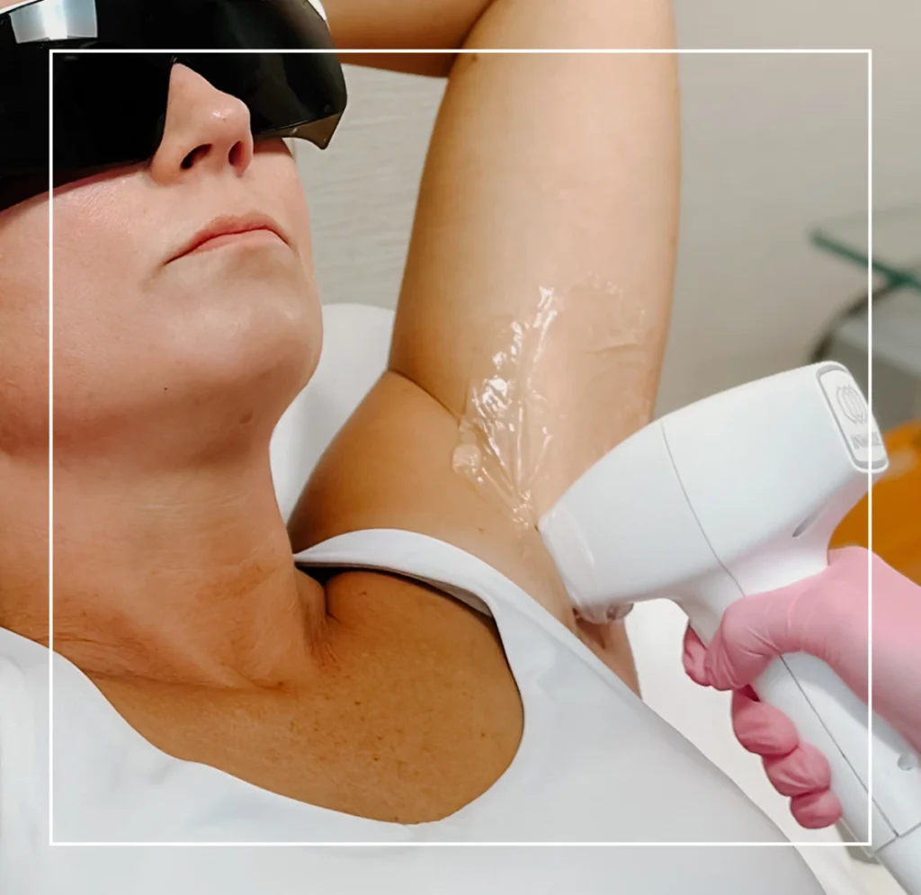 Laser Hair Removal In Geoge UT